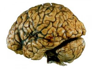 cervelle humaine